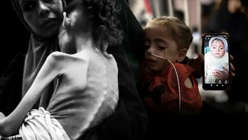 25 Kilodan 10 Kiloya Düşen Meryem'in Açlıkla Mücadele Hikayesi