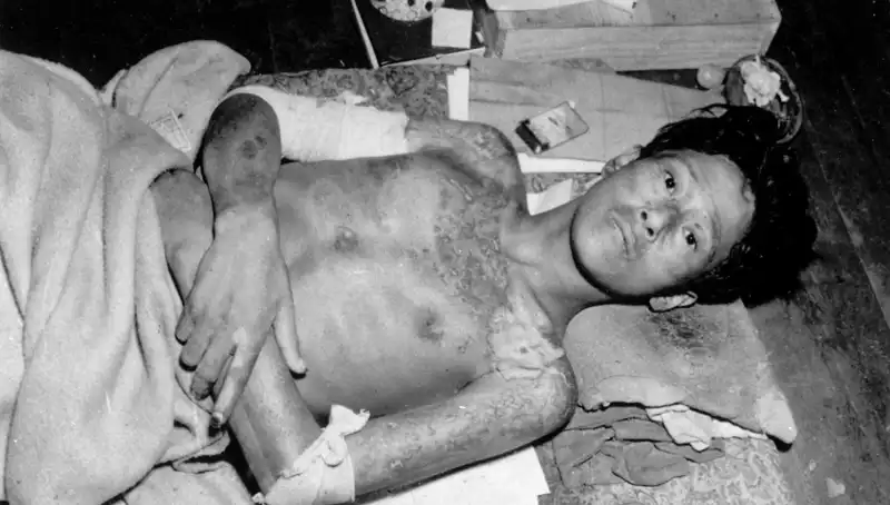 80 Yıl Sonra Nagasaki'den Çarpıcı Uyarı: Nükleer Felaket Kapıda mı?