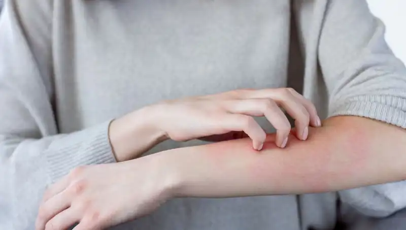 Cilt Kanserinin Gözden Kaçan İki Belirtisi: Dermatologdan Önemli Uyarılar