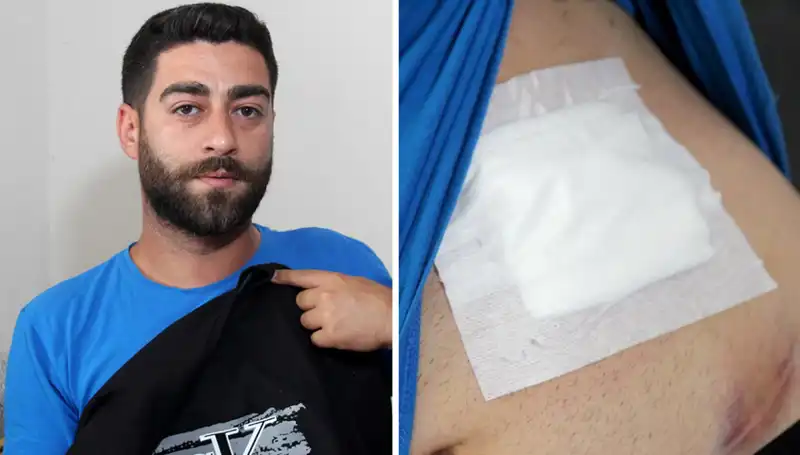 Karnında Ağrı Çeken Kadının Röntgeni Şok Etti: Gerçekler Ortaya Çıktı
