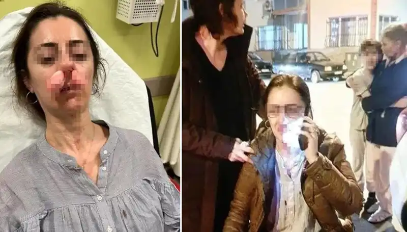 Eşinin Sevgilisini Araba Kapısıyla Vurdu: Şok Edici Olay!