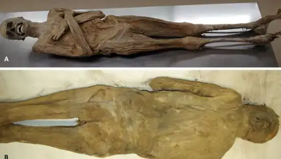 Eski Mısır'dan Farklı Bir Mumyaya Dair Şaşırtıcı Bulgular Ortaya Çıktı