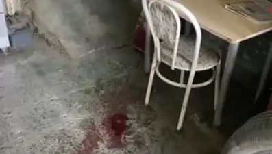 Sandalyeden Düşen Adamın Yaşadığı Korkunç Kaza!